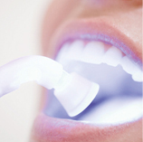 Veneers und Zahnfüllungen bei Zahnarzt Dr. Matheis